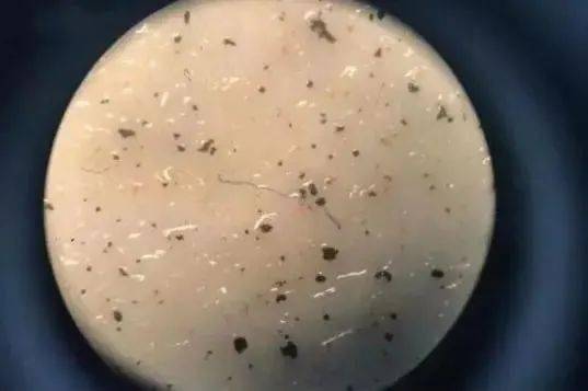 人體糞便中發現神秘物質,科學家稱危險已到來